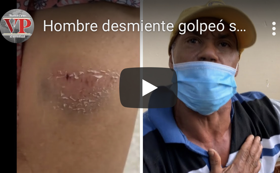 Hombre desmiente golpeó ex pareja en comunidad Porquero