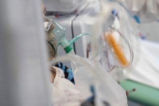 Paciente con COVID mata a otro porque el ruido del respirador le molestaba