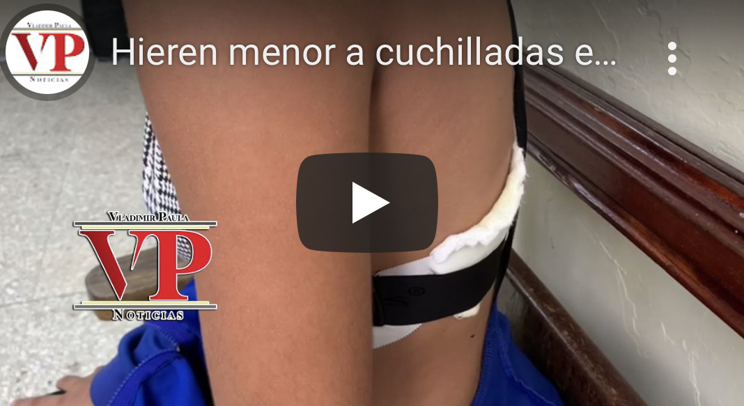 Hieren menor a cuchilladas en medio de riña en sector Los Chiripos SFM