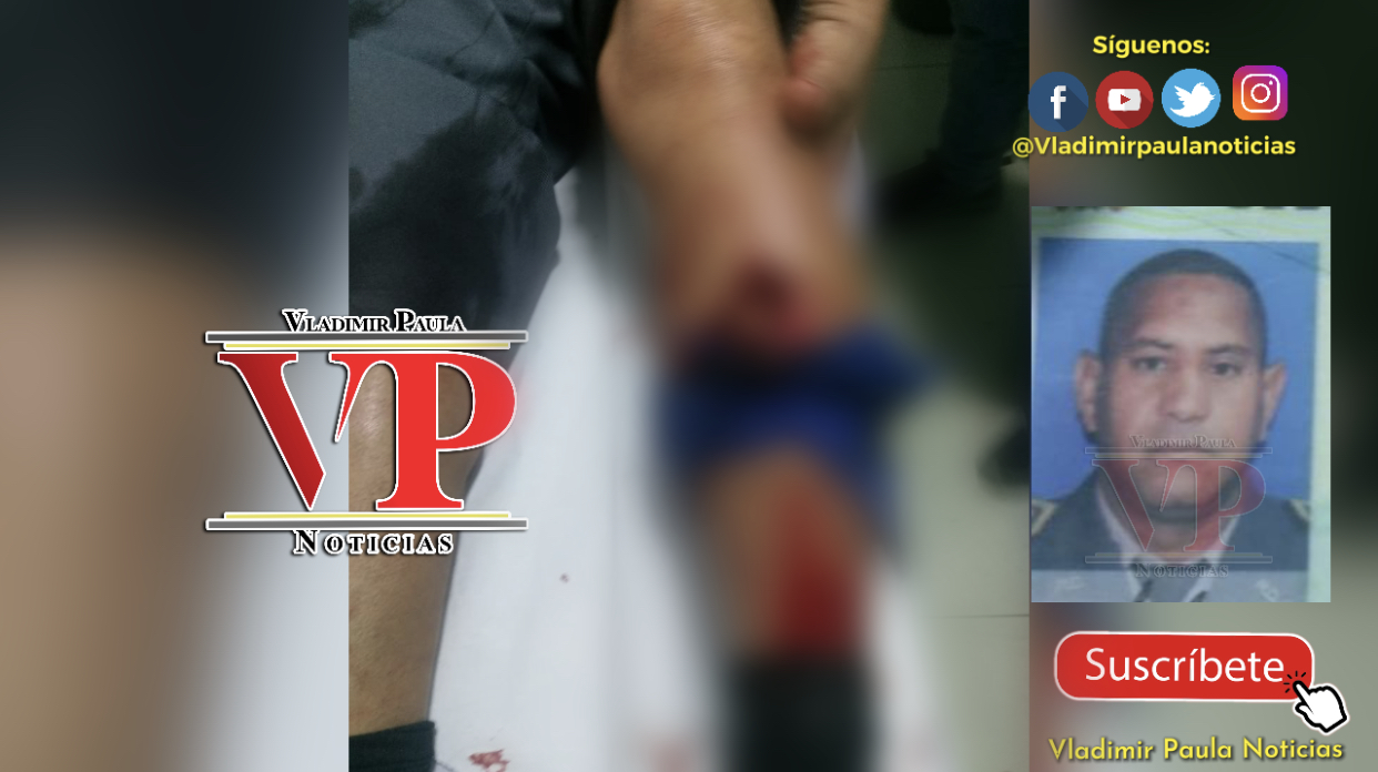 Hieren policía en medio de tiroteo previo al llamado a huelga en SFM