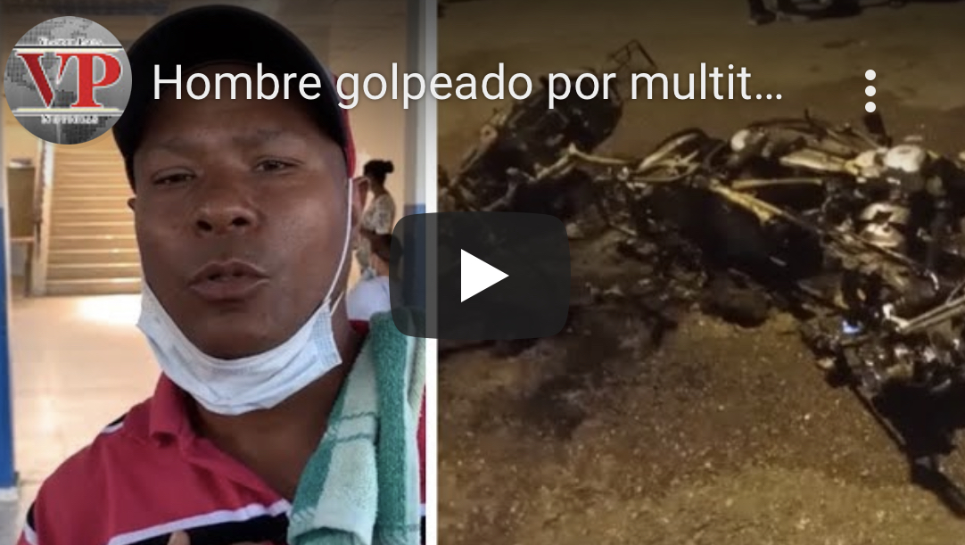 Hombre golpeado por multitud que también le quemó motocicleta en SFM  pide justicia