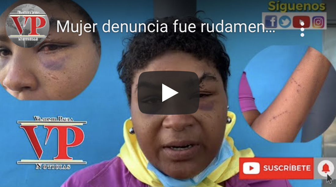 Mujer denuncia fue rudamente golpeada por militares en Samaná; autoridades se niegan a apresarlos