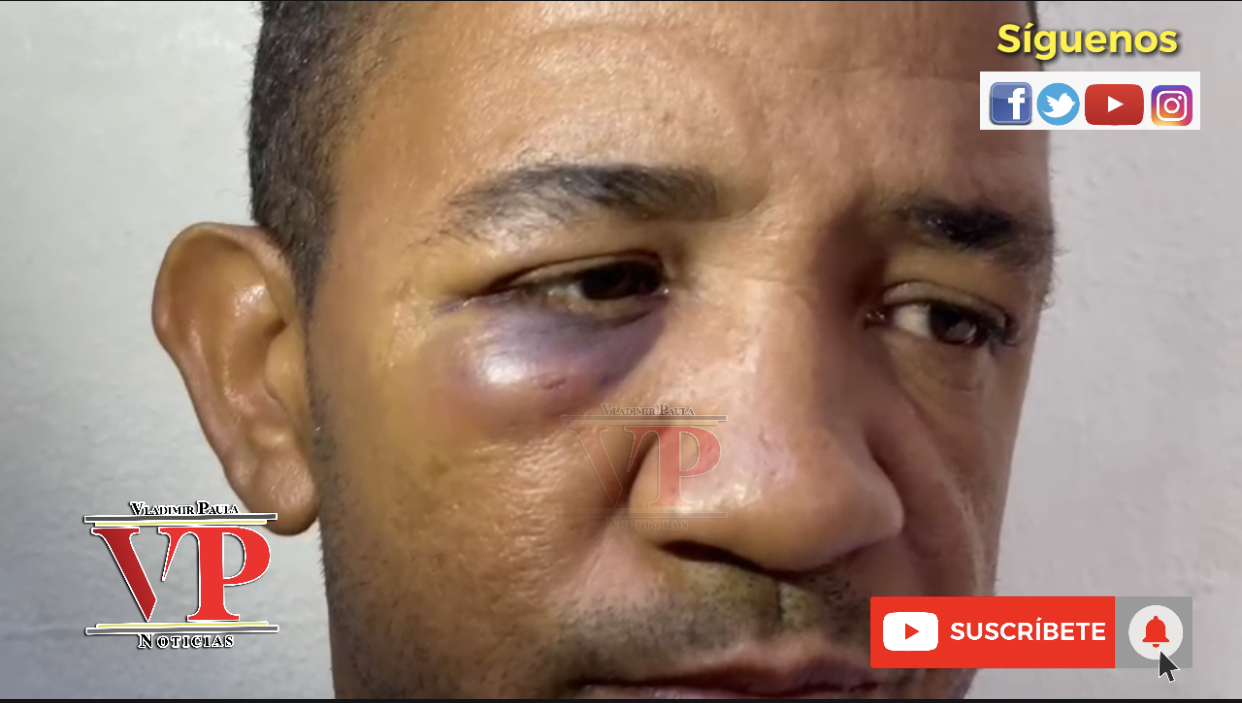 “Un familiar me entró a palos para atracarme” denuncia hombre en SFM