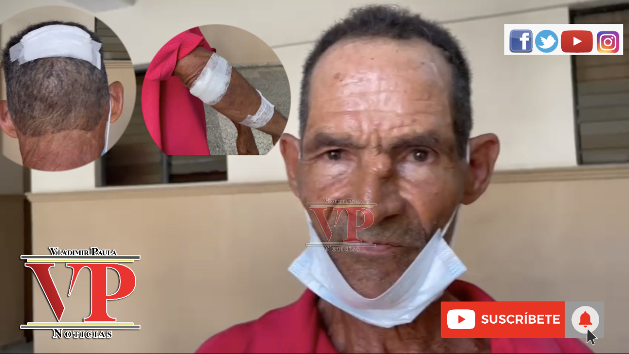 “Así era que te quería encontrar y me entró a palos” narra hombre atacado por primo en SFM