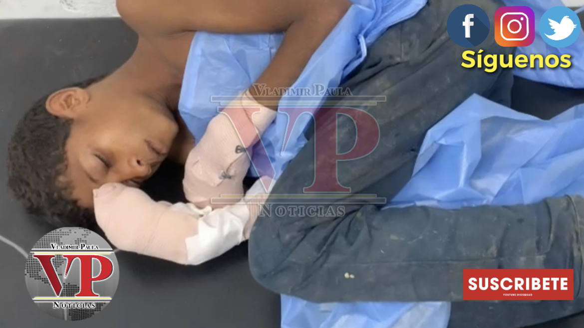 Hombre le quema las manos a su sobrino en SFM porque supuestamente le robó una escalera