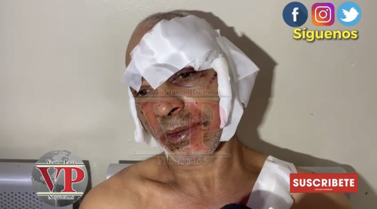 “Me entraron a machetazos y ni se porqué fue”