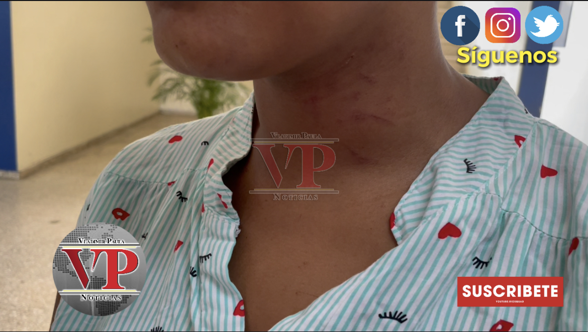 Mujer denuncia fue golpeada y amenazada de muerte por su ex pareja en SFM