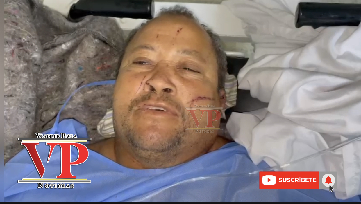 “Me amenazó de muerte hace dos días y hoy me entró a machetazos” denuncia hombre en SFM