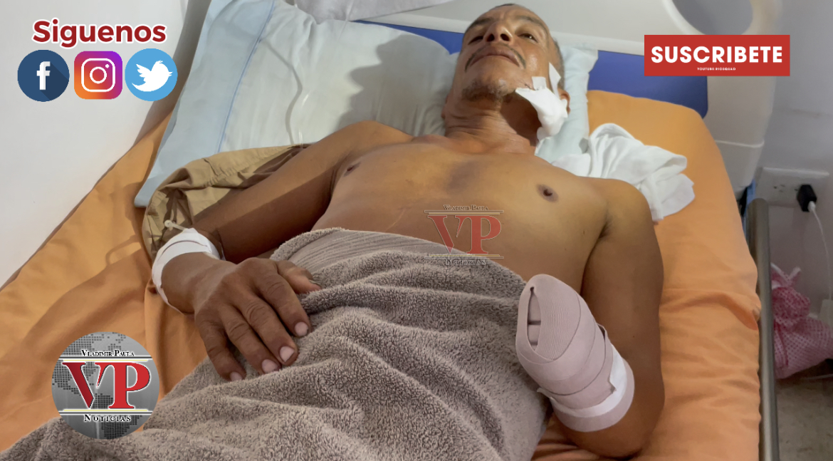 “Fue traicionado lo que él mi hizo” dice hombre al que su exhijastro le cercenó una mano en SFM