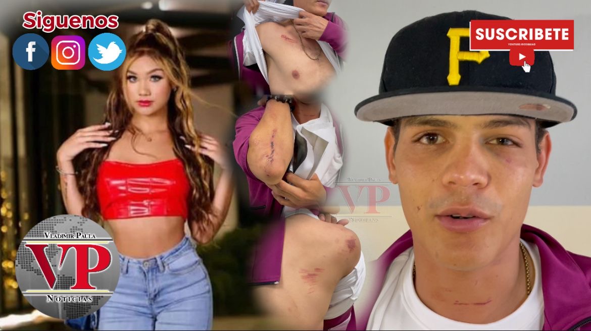 “A Masha la artista que de la cara para que responda por la golpiza que me dieron” dice joven en SFM