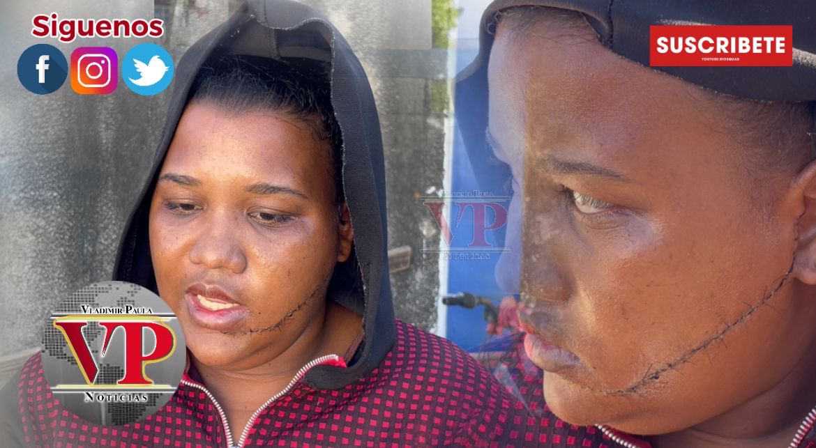 “Me cortaron la cara, me entraron a botellazos, quiero justicia”