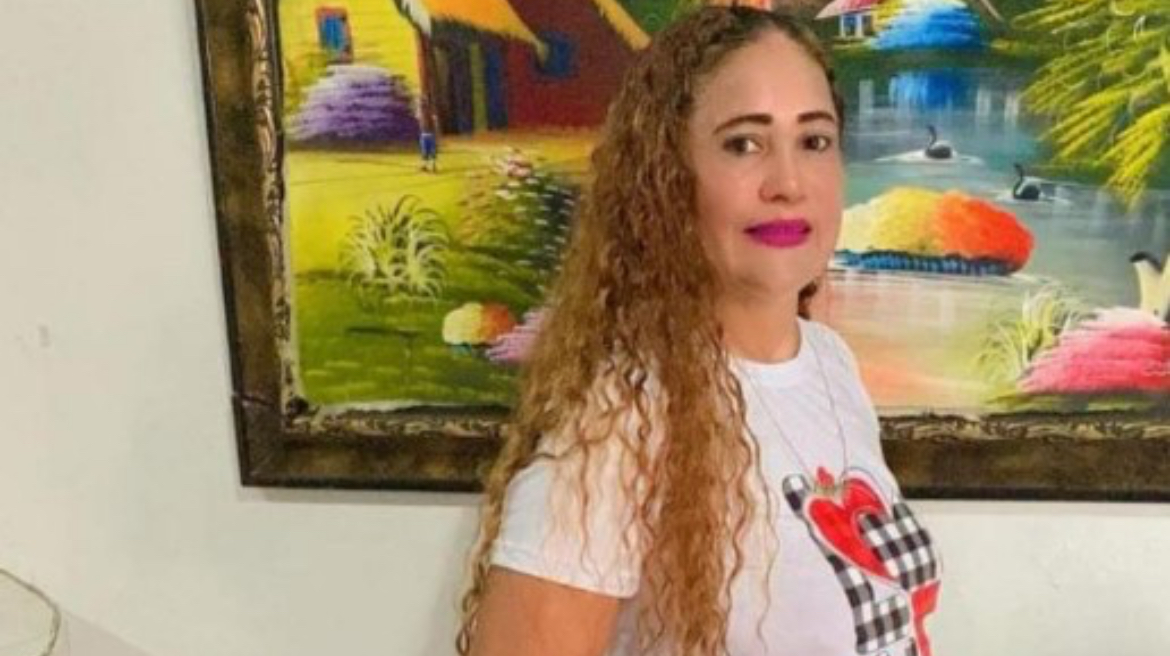 Fallece mujer que fue quemada por expareja en Salcedo