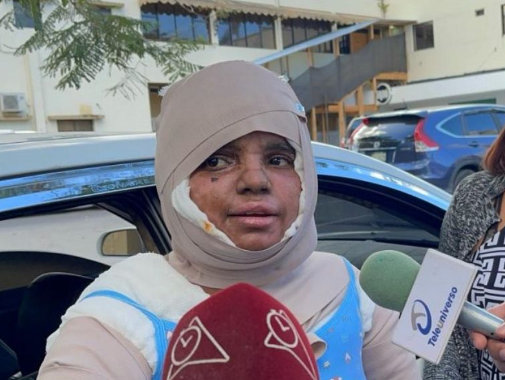 Mujer quemada con aceite caliente  exige justicia