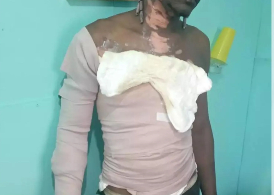 Familiares de hombre quemado con gasolina por una mujer piden justicia