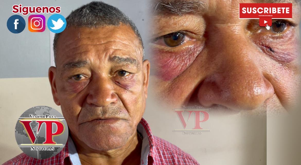 “Me entró a golpes porque le cobre el dinerito que me debía” dice dueño de colmado en SFM