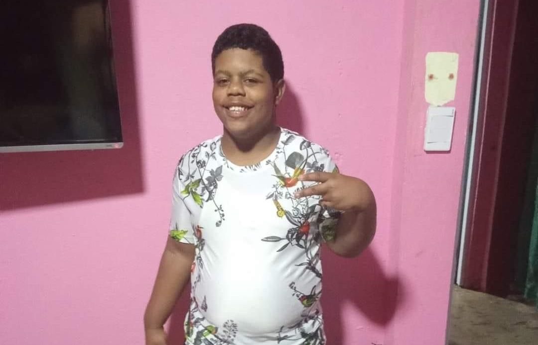 Fallece un segundo menor a causa de explosión en carnaval de Salcedo