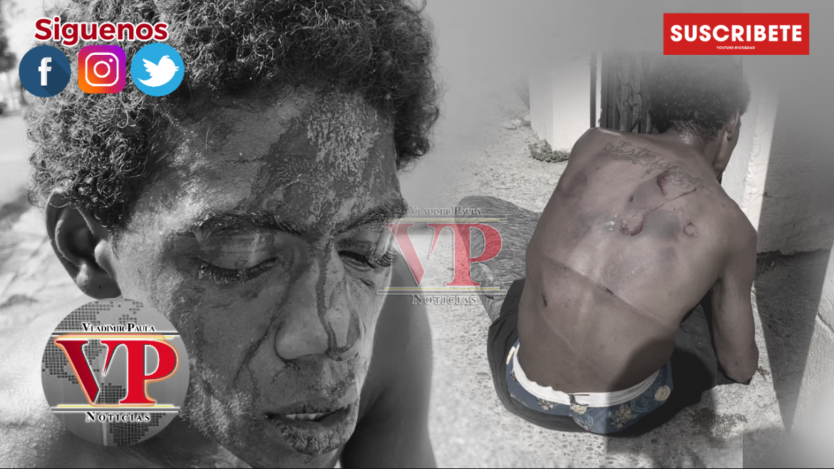 Multitud golpea supuesto ladrón en sector Camino al Medio de SFM