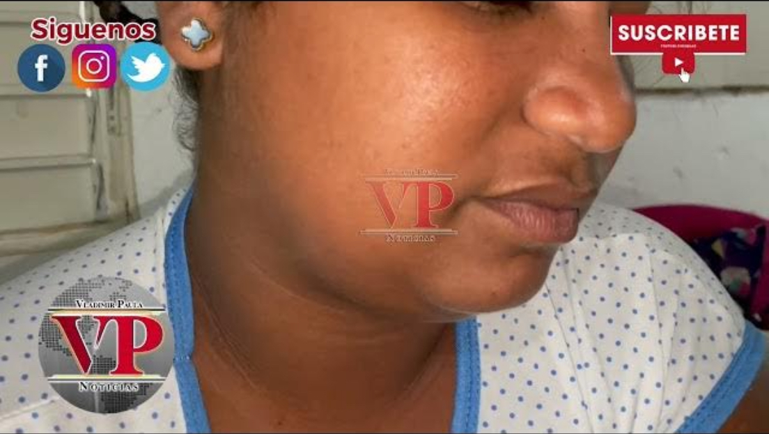 “Yo nada más sentí cuando me dieron el tiro”