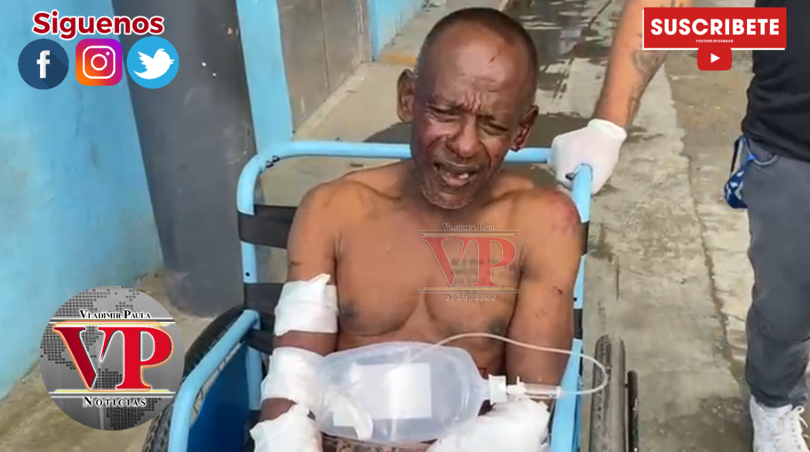 “Yo iba a limpiar un patio y ahí los perros me agarraron”dice hombre fue atacado por dichos animales