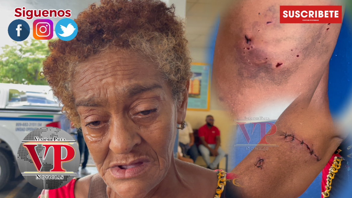 “El perro se le soltó y me fue encima,me mordió y me despilfarro”