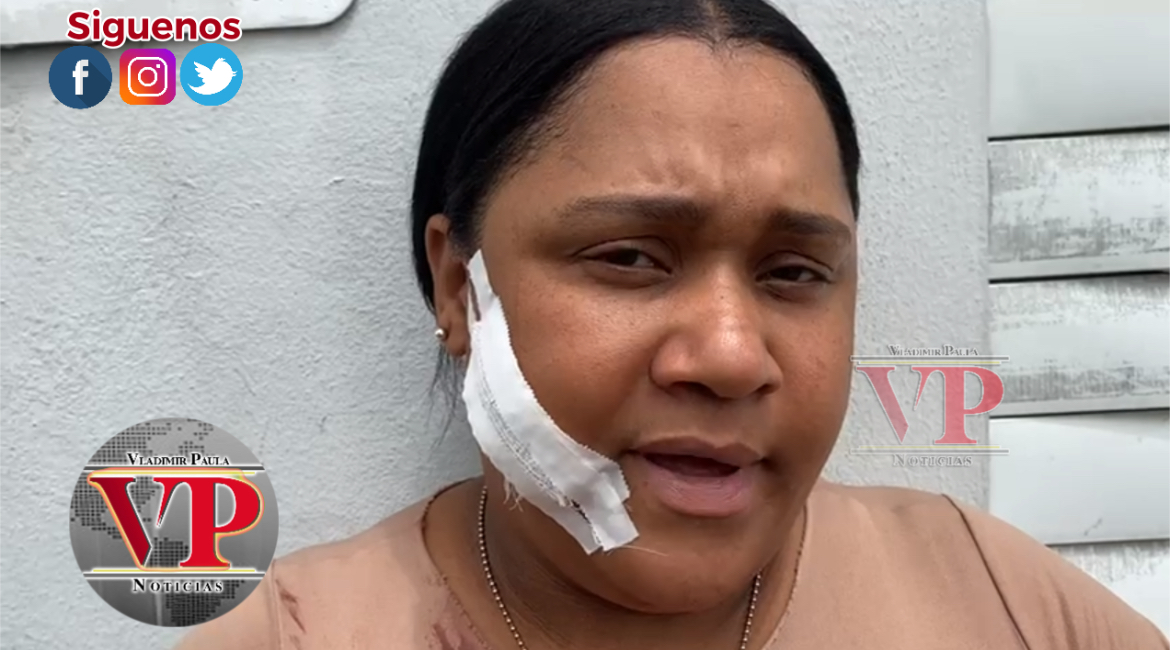 “Ella me está celando con su marido y agarró y me tiró con un Gillette y me cortó en la cara”dice mujer fue herida por otra en Cenoví