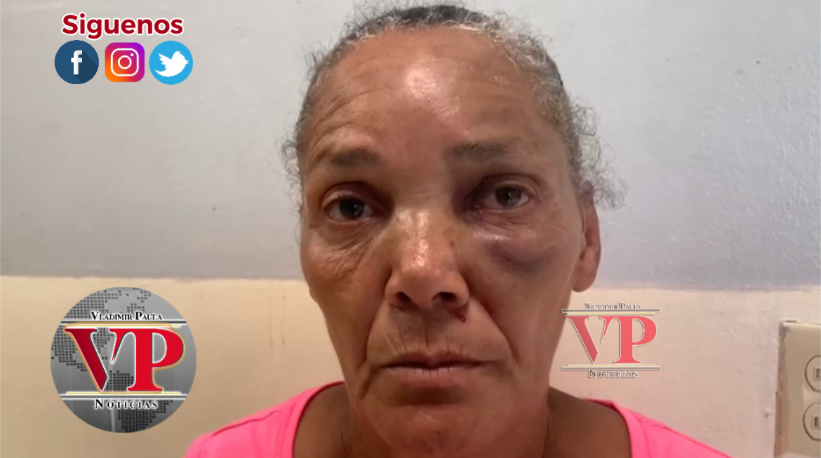 “Le dije que era un mujercita y me mandó a dar una golpiza en SFM”