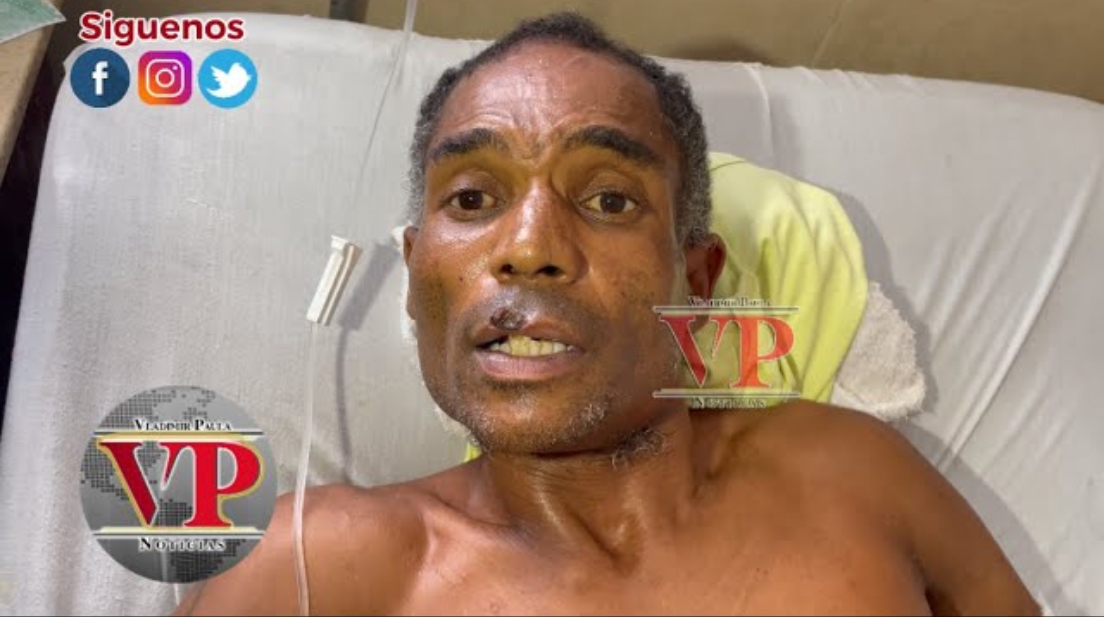 “Me entró a tubazos, machetazos y mordidas, estoy vivo de casualidad” denuncia hombre en SFM