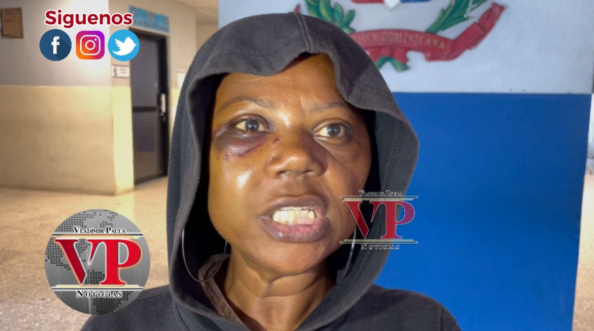 Mujer denuncia ingeniero  le entró a batazos en SFM