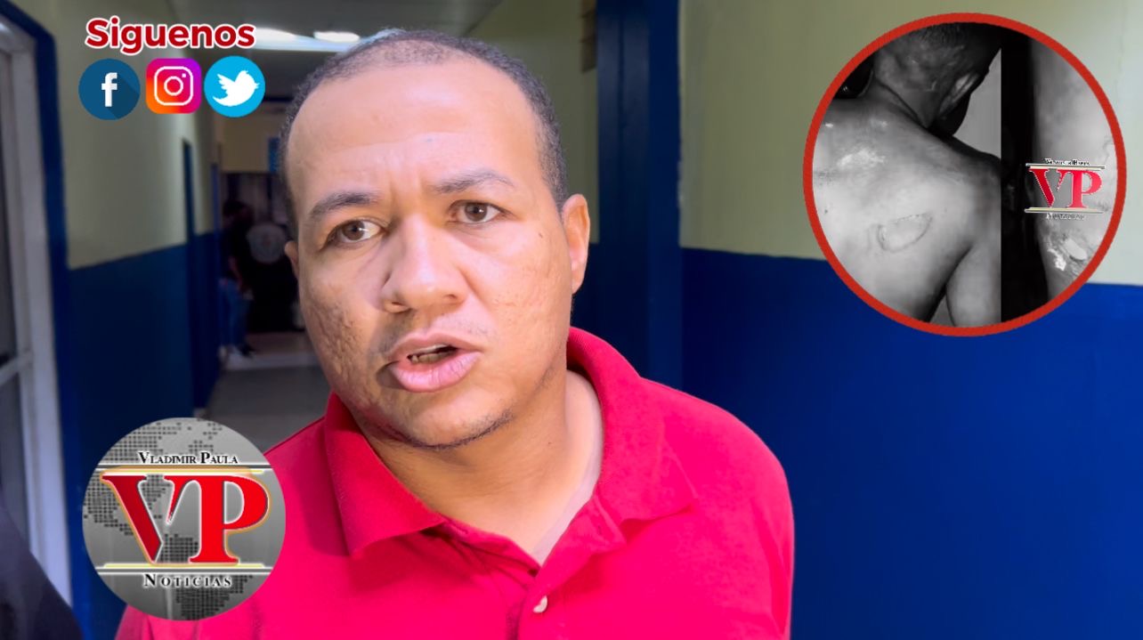 Se entrega acusado de participar en ataque con gasolina a joven en SFM