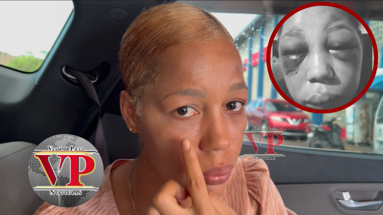 Mujer denuncia brutal agresión por parte de su expareja en SFM; exige justicia