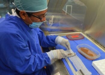 Buscan poner en funcionamiento banco de piel para pacientes quemados en hospital Arturo Grullón