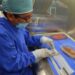 Buscan poner en funcionamiento banco de piel para pacientes quemados en hospital Arturo Grullón