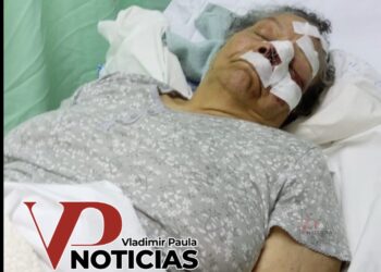 ¡Ataque brutal en plena vía! lanzan peñón a vehículo y dejan a abuela gravemente herida