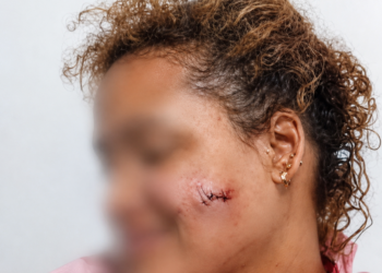 ¡BAÑADA EN SANGRE! Hombre apuñala a su pareja en Puerto Plata