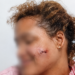 ¡BAÑADA EN SANGRE! Hombre apuñala a su pareja en Puerto Plata